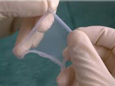 استفاده از پانسمان پرده آمینون در بیمارستان سوختگی گناوه