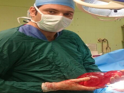 در بیمارستان کنگان:توده ۳۵ سانتی‌متری از شکم یک زن خارج شد+عکس