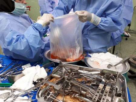 اعضای بدن فوتبالیست نوجوان بوشهری به پنج بیمار زندگی دوباره بخشید